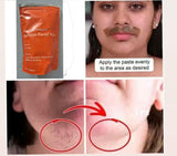 5 Minutes Painless Turmeric Facial Wax 100 gm